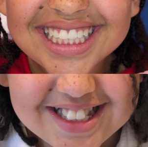 From Gap to Glow